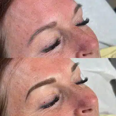 beforeafter1.jpg beforeafter1.jpg Aura Esthetics & Ink