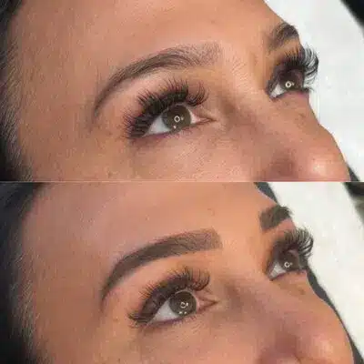 beforeafter6.jpg beforeafter6.jpg Aura Esthetics & Ink